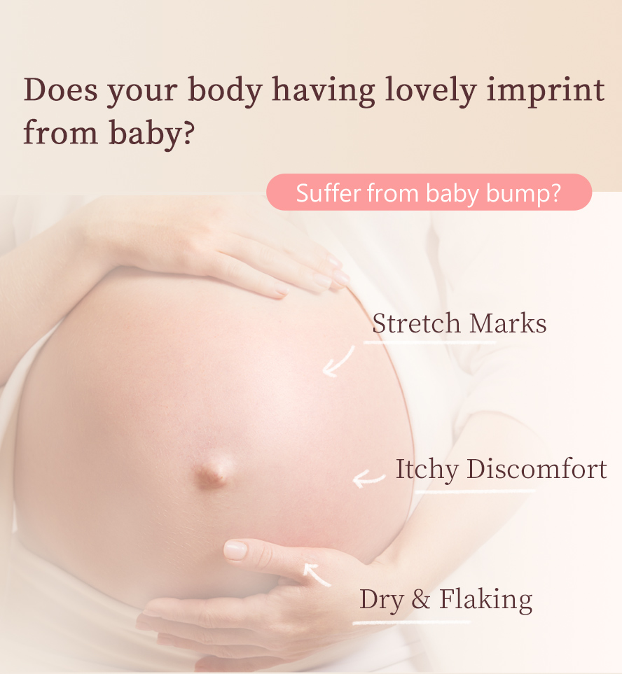 Mommies belly can easily suffer from strectch marks, itchy, dry, and flaky skin during pregnancy.